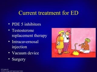 Current treatment for ED PDE 5 inhibitors Testosterone replacement therapy Intracavernosal injection Vacuum device Surgery 