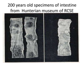 Deadly complications Intestinal BleedIntestinal perforation Osteomyelitis  