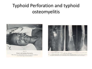 200 years old specimens of intestine from  Hunterian museum of RCSE
