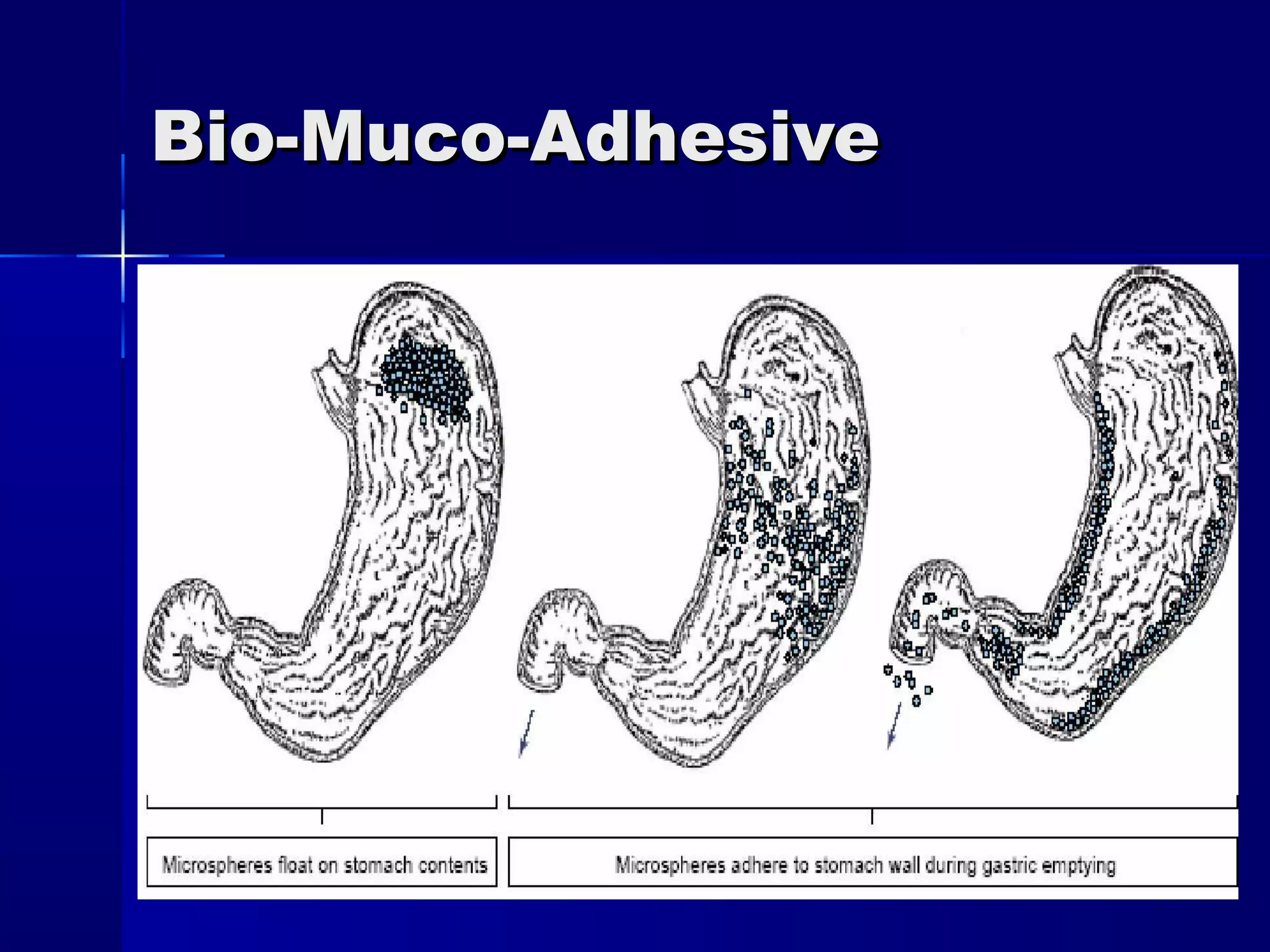 Bio-Muco-Adhesive




March 22, 2013   DrLDP   48
 