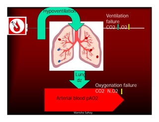 Hypoventilation
                              Ventilation
                              failure
                              CO2 , ,O2




               Lung
                dz
                        Oxygenation failure
                        CO2 N,O2
      Arterial blood pAO2

              Manisha Sahay
 