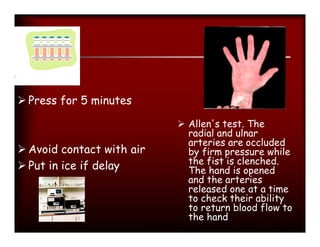  Press for 5 minutes

                                      Allen's test. The
                                       radial and ulnar
                                       arteries are occluded
 Avoid contact with air               by firm pressure while
                                       the fist is clenched.
 Put in ice if delay                  The hand is opened
                                       and the arteries
                                       released one at a time
                                       to check their ability
                                       to return blood flow to
                                       the hand
                           Manisha Sahay
 