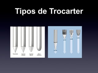 Tipos de Trocarter 