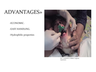 ADVANTAGES»
 -ECONOMIC.

 -EASY HANDLING.

 -Hydrophilic properties




                           FIG.-12 MAKING CORRECT alginate
                           impression.
 