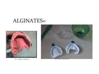 ALGINATES»




FIG.-6 Alginate impression   FIG7- Alginate impressions
 