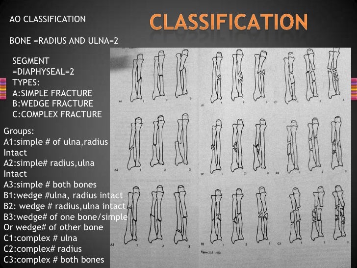 Dr. ms goud management of forearm fractures