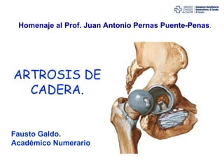 Homenaje al Prof. Juan Antonio Pernas Puente-Penas.




ARTROSIS DE
  CADERA.


Fausto Galdo.
Académico Numerario
 