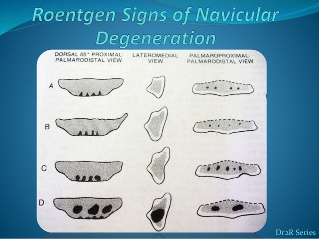 of x-ray parts cassette Dr syndrome navicular rahimzadeh