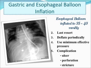 Esophageal Balloon inflated to  35 - 40  mmHg Last resort Deflate periodically Use minimum effective pressure Complication - ulcer - perforation - stricture Gastric and Esophageal Balloon Inflation 