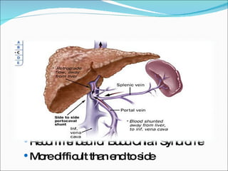 Side to Side portocaval shunt: Maintain the anatomic continuity of the portal vein Encephalopathy rate : no difference Decompress the sinusoidal pressure -> better ascitis control Recommended for Budd Chiari Syndrome More difficult than end to side 