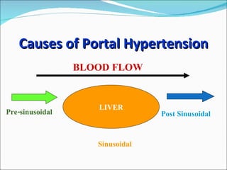 Causes of Portal Hypertension Pre-sinusoidal Sinusoidal Post Sinusoidal BLOOD FLOW LIVER 