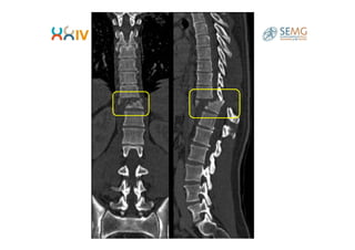 Dr-Sanchez-Sanchez-Aula-de-diagnostico-por-imagen-RX-de-columna.pdf