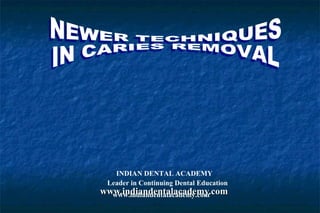 INDIAN DENTAL ACADEMY
 Leader in Continuing Dental Education
www.indiandentalacademy.com
  www.indiandentalacademy.com
 