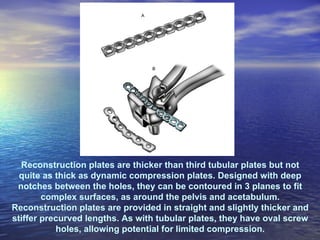 Reconstruction plates are thicker than third tubular plates but not
  quite as thick as dynamic compression plates. Designed with deep
 notches between the holes, they can be contoured in 3 planes to fit
        complex surfaces, as around the pelvis and acetabulum.
Reconstruction plates are provided in straight and slightly thicker and
stiffer precurved lengths. As with tubular plates, they have oval screw
           holes, allowing potential for limited compression.
 