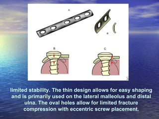 limited stability. The thin design allows for easy shaping
 and is primarily used on the lateral malleolus and distal
      ulna. The oval holes allow for limited fracture
      compression with eccentric screw placement.
 