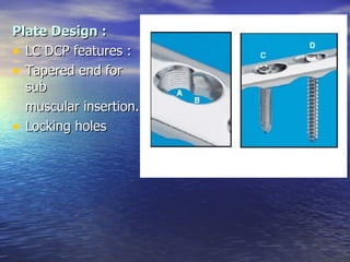 Plate Design :
• LC DCP features :
• Tapered end for
  sub
  muscular insertion.
• Locking holes
 