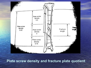 Plate screw density and fracture plate quotient
 