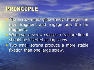 PRINCIPLE
• The screw must glide freely through the
  near fragment and engage only the far
  fragment.
• Wherever a screw crosses a fracture line it
  should be inserted as lag screw.
• Two small screws produce a more stable
  fixation than one large screw.
 