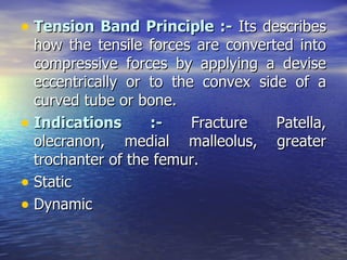 • Tension Band Principle :- Its describes
  how the tensile forces are converted into
  compressive forces by applying a devise
  eccentrically or to the convex side of a
  curved tube or bone.
• Indications      :-    Fracture   Patella,
  olecranon, medial malleolus, greater
  trochanter of the femur.
• Static
• Dynamic
 