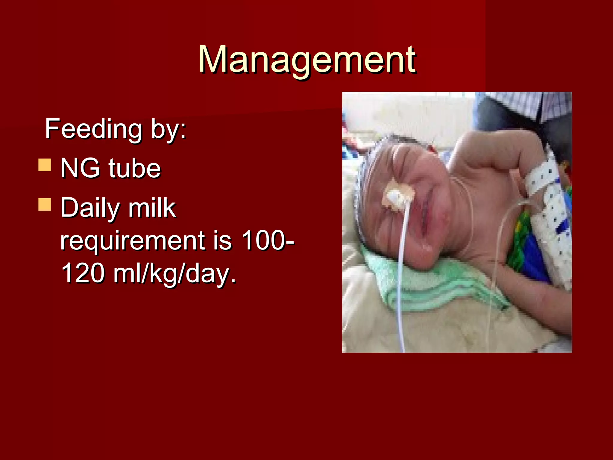 ManagementManagement
Feeding by:Feeding by:
 NG tubeNG tube
 Daily milkDaily milk
requirement is 100-requirement is 100-
120 ml/kg/day.120 ml/kg/day.
 