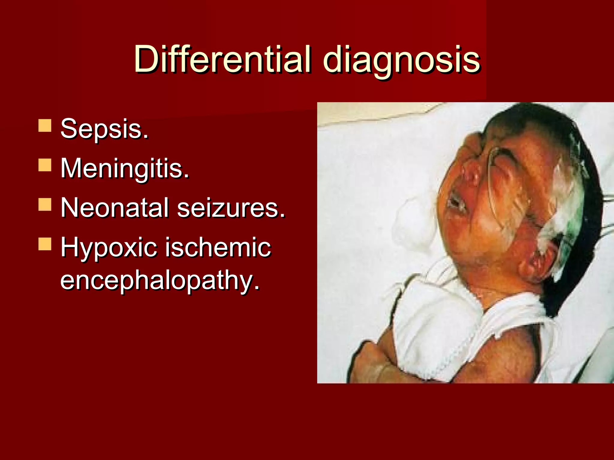 Differential diagnosisDifferential diagnosis
 Sepsis.Sepsis.
 Meningitis.Meningitis.
 Neonatal seizures.Neonatal seizures.
 Hypoxic ischemicHypoxic ischemic
encephalopathy.encephalopathy.
 