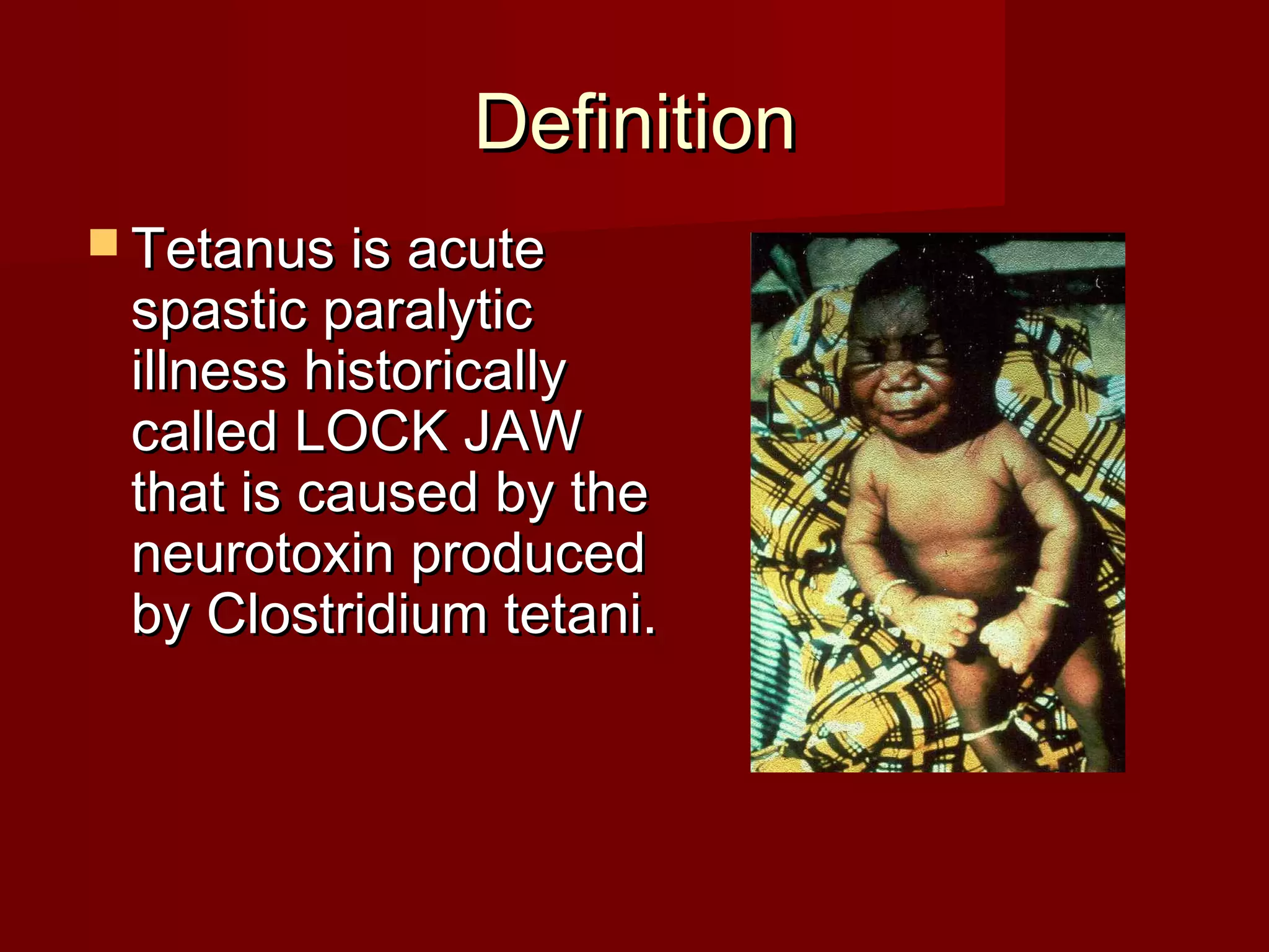 DefinitionDefinition
 Tetanus is acuteTetanus is acute
spastic paralyticspastic paralytic
illness historicallyillness historically
called LOCK JAWcalled LOCK JAW
that is caused by thethat is caused by the
neurotoxin producedneurotoxin produced
by Clostridium tetani.by Clostridium tetani.
 