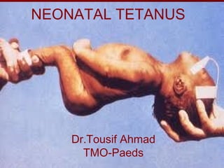 NEONATAL TETANUS
Dr.Tousif Ahmad
TMO-Paeds
 