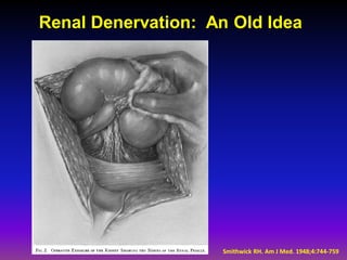 Renal Denervation: An Old Idea




                    Smithwick RH. Am J Med. 1948;4:744-759
 