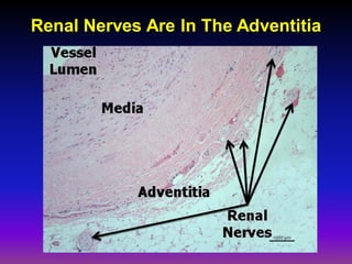 Renal Nerves Are In The Adventitia
 