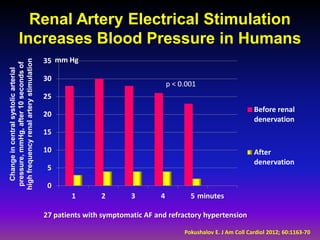 Renal Artery Electrical Stimulation
              Increases Blood Pressure in Humans
                                          35 mm Hg
high frequency renal artery stimulation
 pressure, mmHg, after 10 seconds of
   Change in central systolic arterial




                                          30
                                                                                p < 0.001
                                          25
                                                                                                               Before renal
                                          20
                                                                                                               denervation
                                          15

                                          10                                                                   After
                                                                                                               denervation
                                           5

                                           0
                                                  1       2        3        4          5 minutes

                                          27 patients with symptomatic AF and refractory hypertension

                                                                                     Pokushalov E. J Am Coll Cardiol 2012; 60:1163-70
 