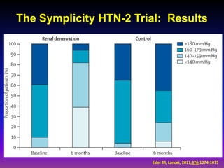 The Symplicity HTN-2 Trial: Results




                        Esler M, Lancet, 2011;376:1074-1075
 