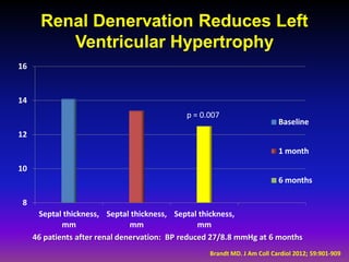 Renal Denervation Reduces Left
          Ventricular Hypertrophy
16


14
                                             p = 0.007
                                                                          Baseline
12
                                                                          1 month

10
                                                                          6 months

 8
      Septal thickness, Septal thickness, Septal thickness,
             mm                 mm                mm
     46 patients after renal denervation: BP reduced 27/8.8 mmHg at 6 months
                                                   Brandt MD. J Am Coll Cardiol 2012; 59:901-909
 