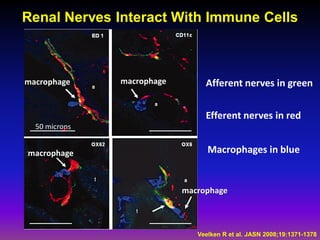 Renal Nerves Interact With Immune Cells



macrophage     macrophage        Afferent nerves in green


                                 Efferent nerves in red
  50 microns


macrophage                        Macrophages in blue


                            macrophage



                               Veelken R et al. JASN 2008;19:1371-1378
 