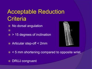 Distal Reduction Dr. yt reddy distal radius fractures modified | PPTX