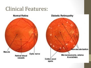 Clinical Features:
 