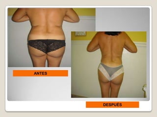 ANTES




        DESPUÉS
 