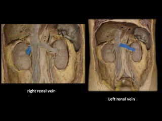 right renal vein
Left renal vein
 