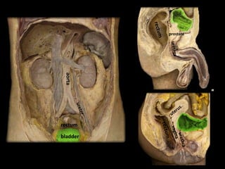 prostate
aorta
rectum
bladder
 