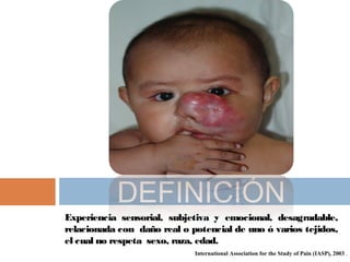 Experiencia sensorial, subjetiva y emocional, desagradable,
relacionada con daño real o potencial de uno ó varios tejidos,
el cual no respeta sexo, raza, edad.
DEFINICIÓN
International Association for the Study of Pain (IASP), 2003 .
 