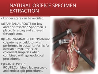 Dr Aayush Rai Minimal invasive surgery ppt.pptx