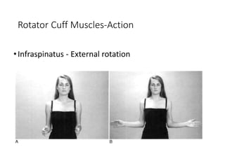 Rotator Cuff External Rotation Interal Rotation shoulder injuries.pptx