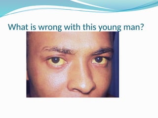 What is wrong with this young man?
 