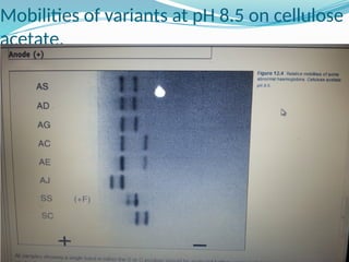 Mobilities of variants at pH 8.5 on cellulose
acetate.
 