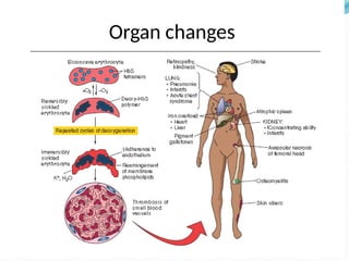 Organ changes
 