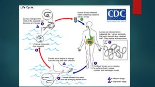 Dracunculus medinensis