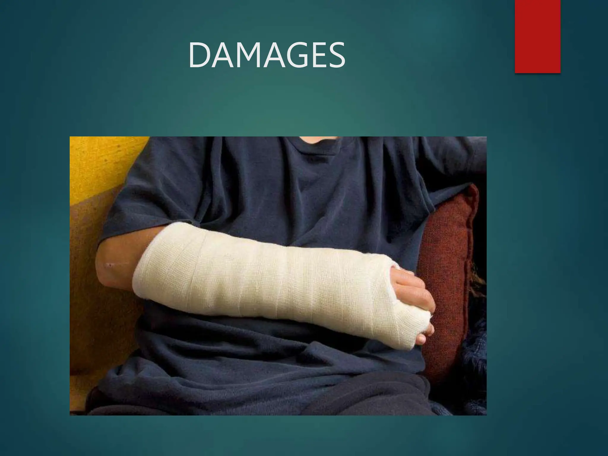 DAMAGES
 