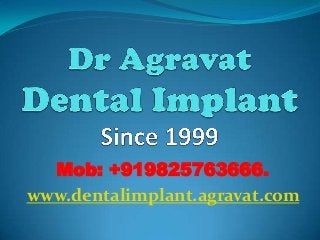 Mob: +919825763666.
www.dentalimplant.agravat.com

 