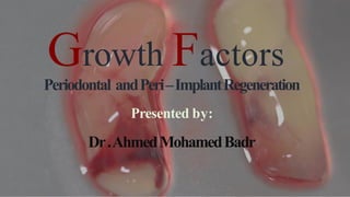 Growth Factors
Periodontal andPeri–ImplantRegeneration
Presented by:
Dr.AhmedMohamedBadr
 