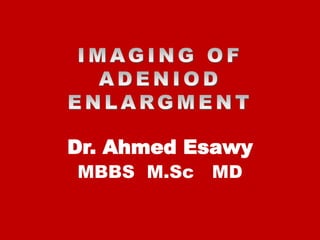 Dr. Ahmed Esawy
MBBS M.Sc MD
 