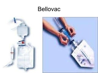 Bellovac 
